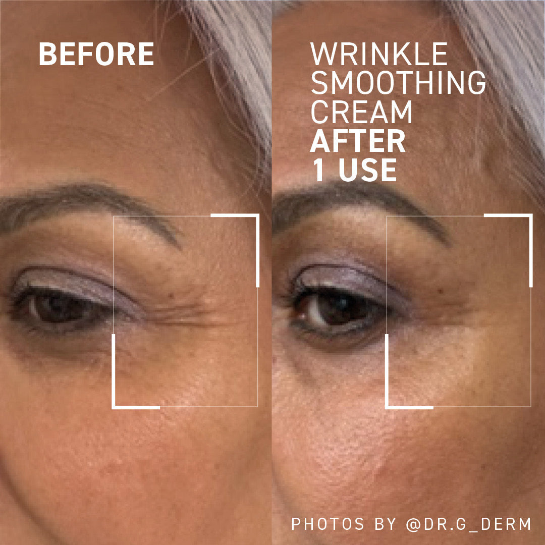 WRINKLE SMOOTHING CREAM
