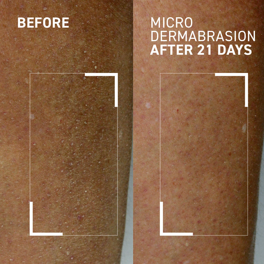 Body polishing exfolitor before and after