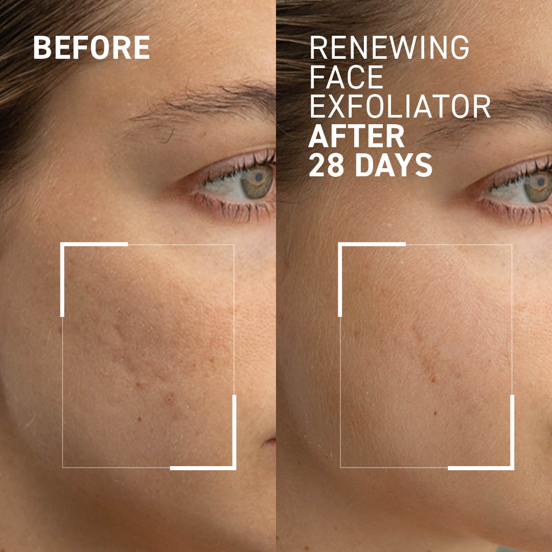 GENTLE FACE EXFOLIATOR