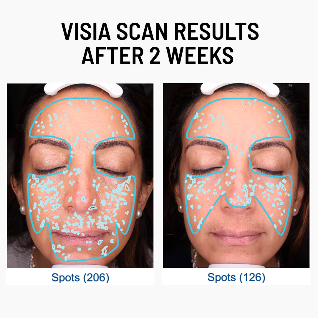 Advanced Face Exfoliator