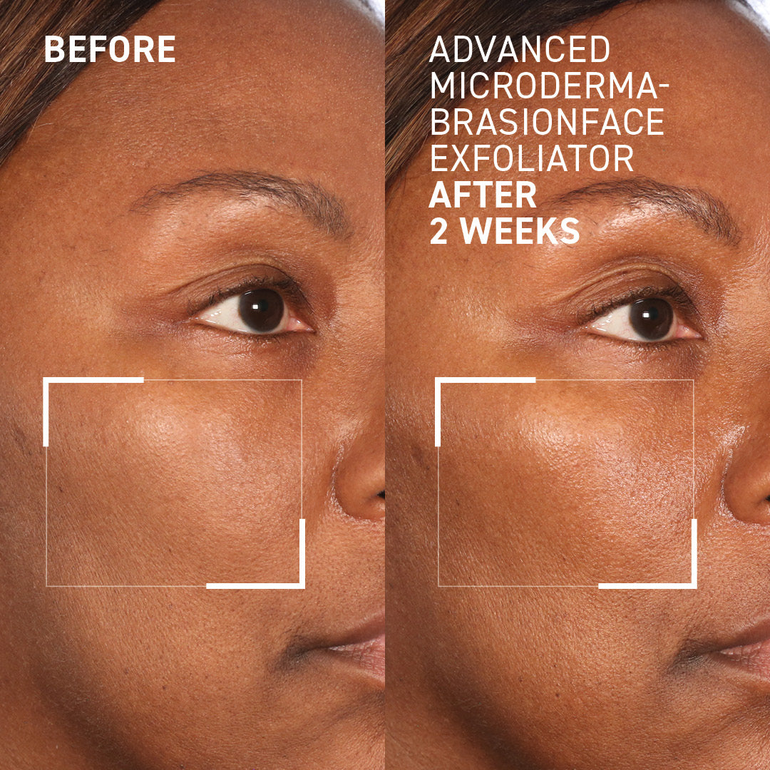 Advanced Face Exfoliator