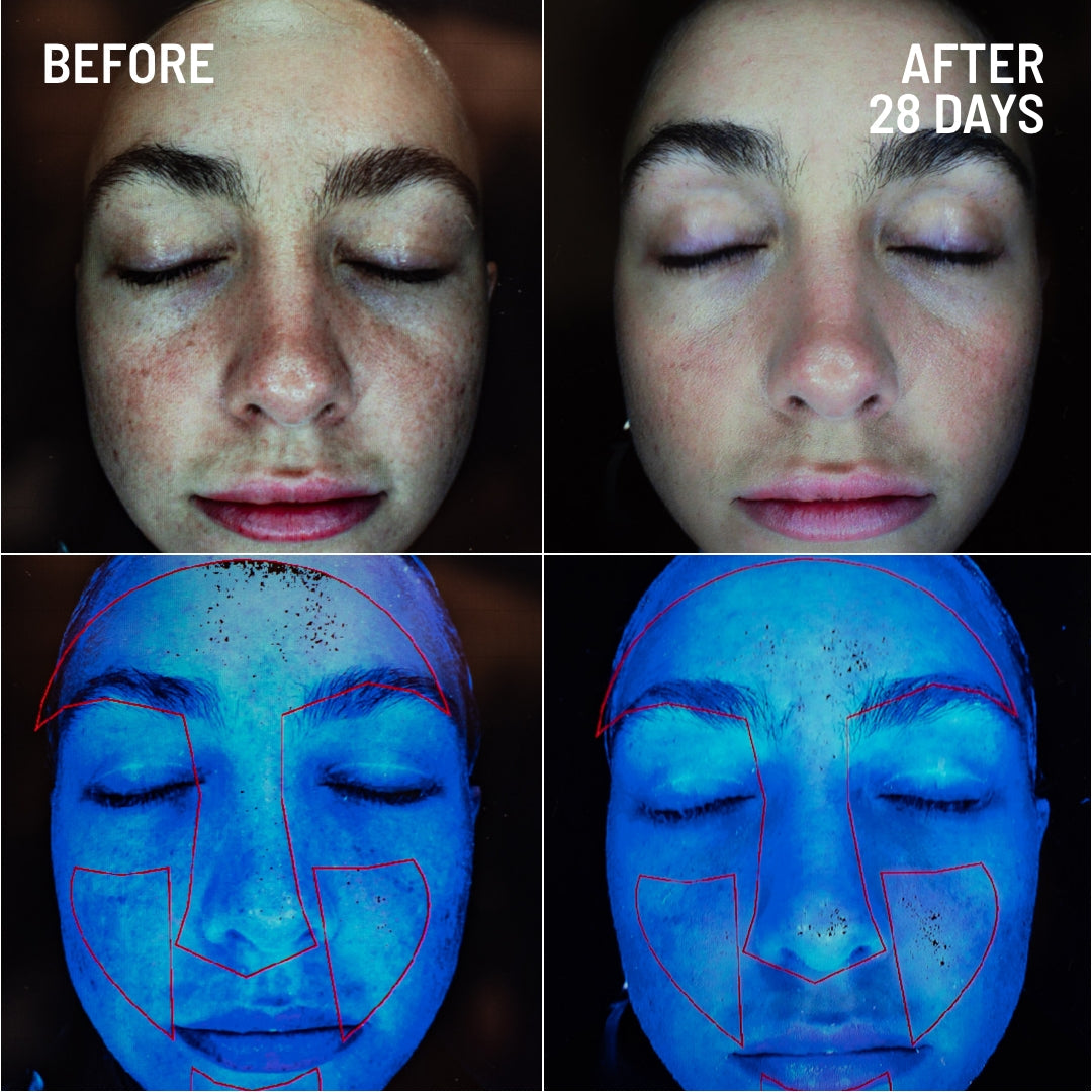 GENTLE FACE EXFOLIATOR