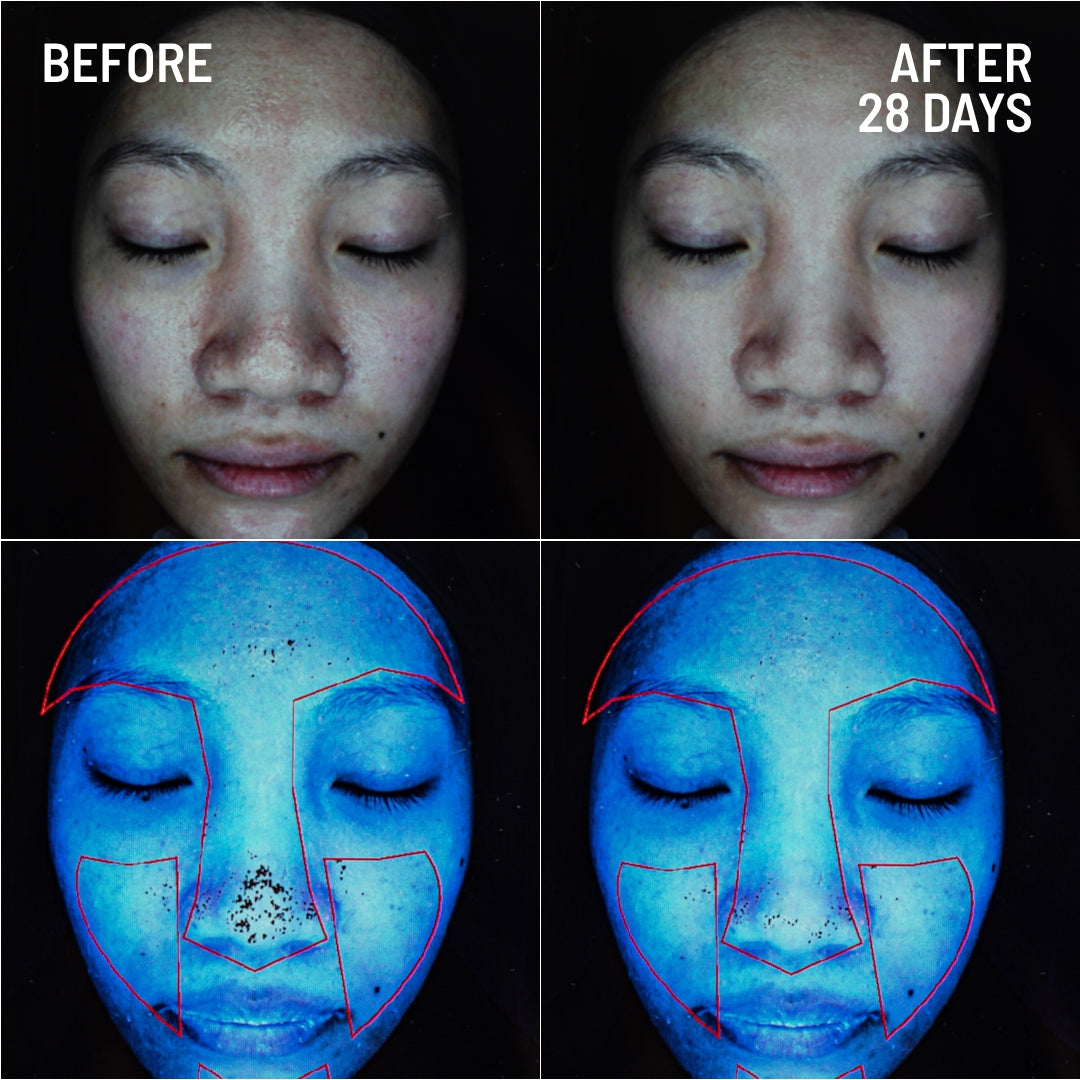 GENTLE FACE EXFOLIATOR